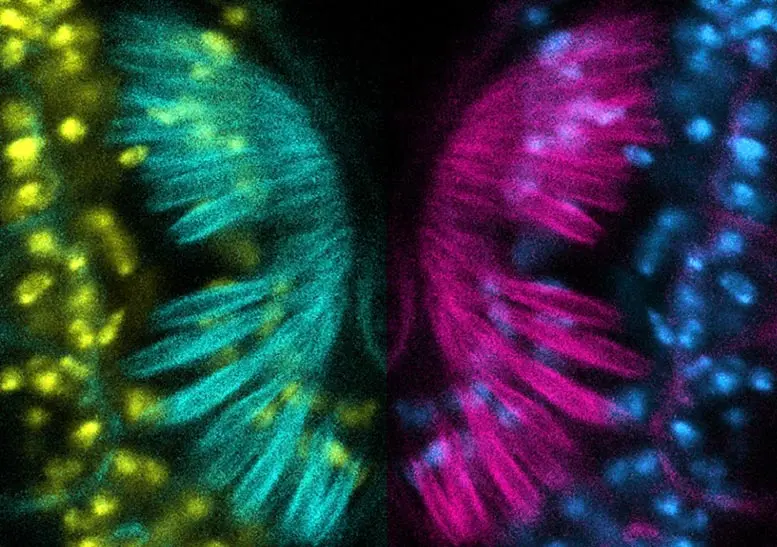 اندام جانستون